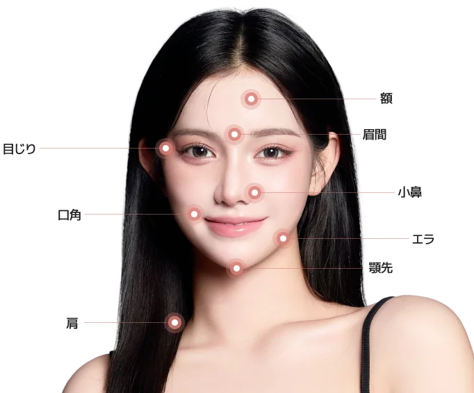 ボツリヌストキシン注射の部位を示す女性の顔のイラスト。