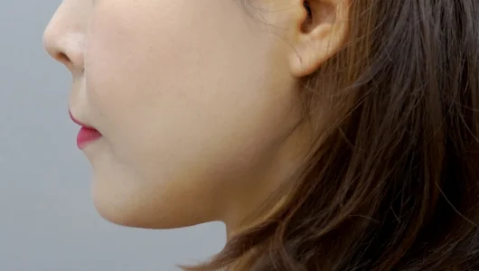 女性の横顔で、顎のラインが強調されている。