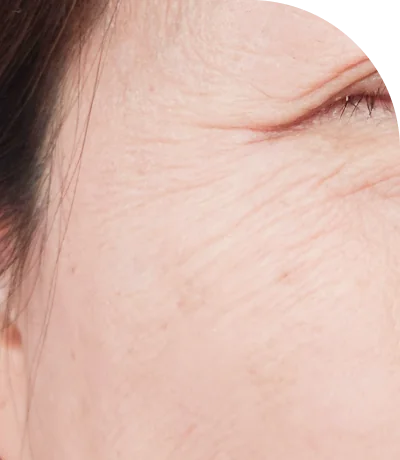 目尻のしわが目立つ、女性の顔のクローズアップ