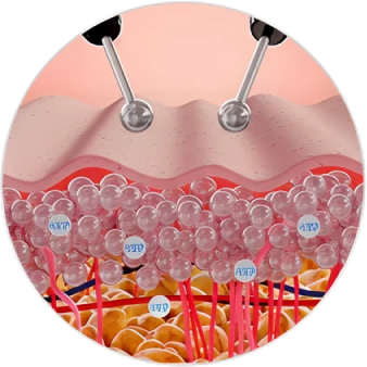 電極が皮膚に当てられ、細胞構造に影響を与える様子。