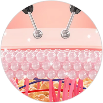 肌の断面図と、表面に当てられた2つの美容機器のイメージ図。