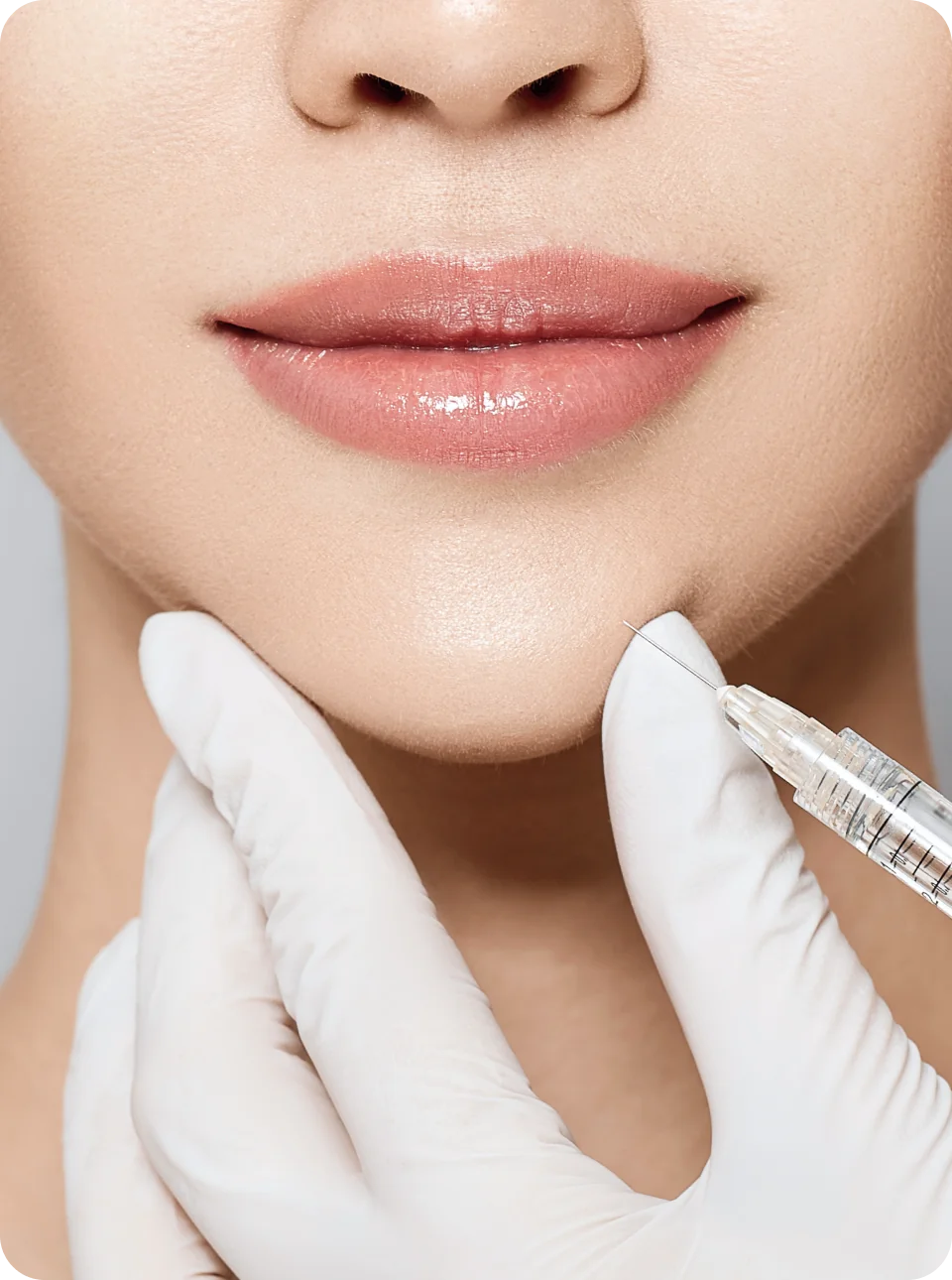 顎にヒアルロン酸注射をする様子