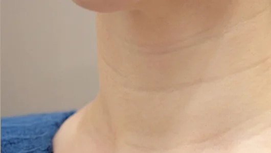 首のしわが目立つ女性の肌のクローズアップ写真