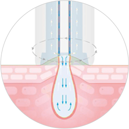 肌の毛穴に液体が注入され、吸引される様子を示した図。