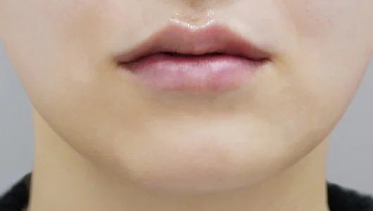 ふっくらとした、光沢のある唇のクローズアップ写真