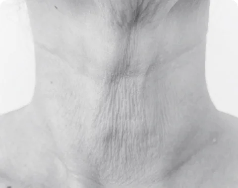 首のしわが目立つ、グレースケールのイメージです。