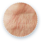 首のシワをクローズアップした画像。