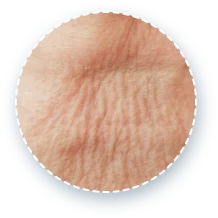 首のしわをクローズアップした画像。