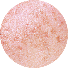 肌のクローズアップ、シミやそばかすが見える