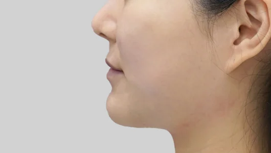 女性の顔の横顔、顎のラインが強調されている。