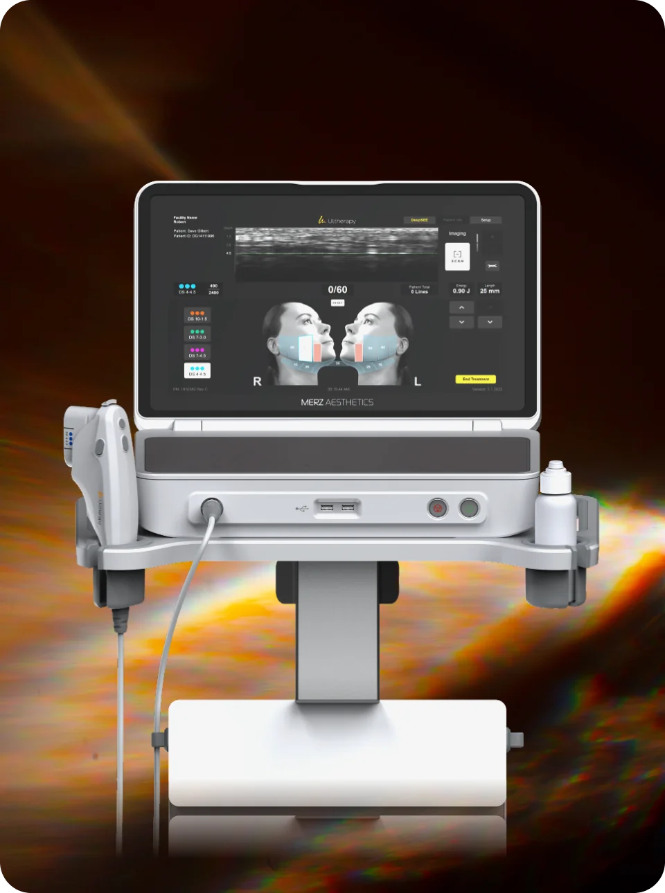 ウルセラピープライムの画像：施術画面とアプリケーターを備えた医療機器。