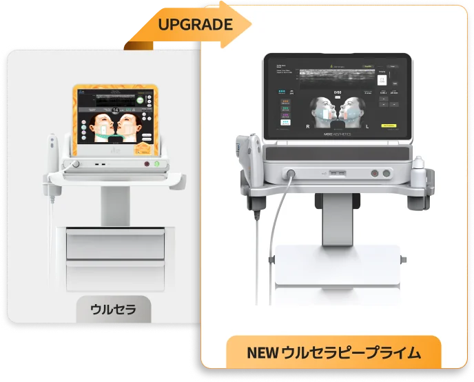 ウルセラからウルセラピープライムへのアップグレードを示す画像