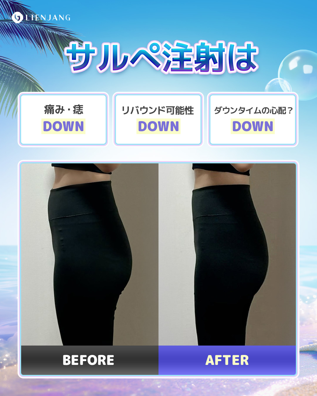 #シワ改善注射 #しわ治療 #美肌 #MTS #ルミヴィオン #ポテンツァ #肌質改善